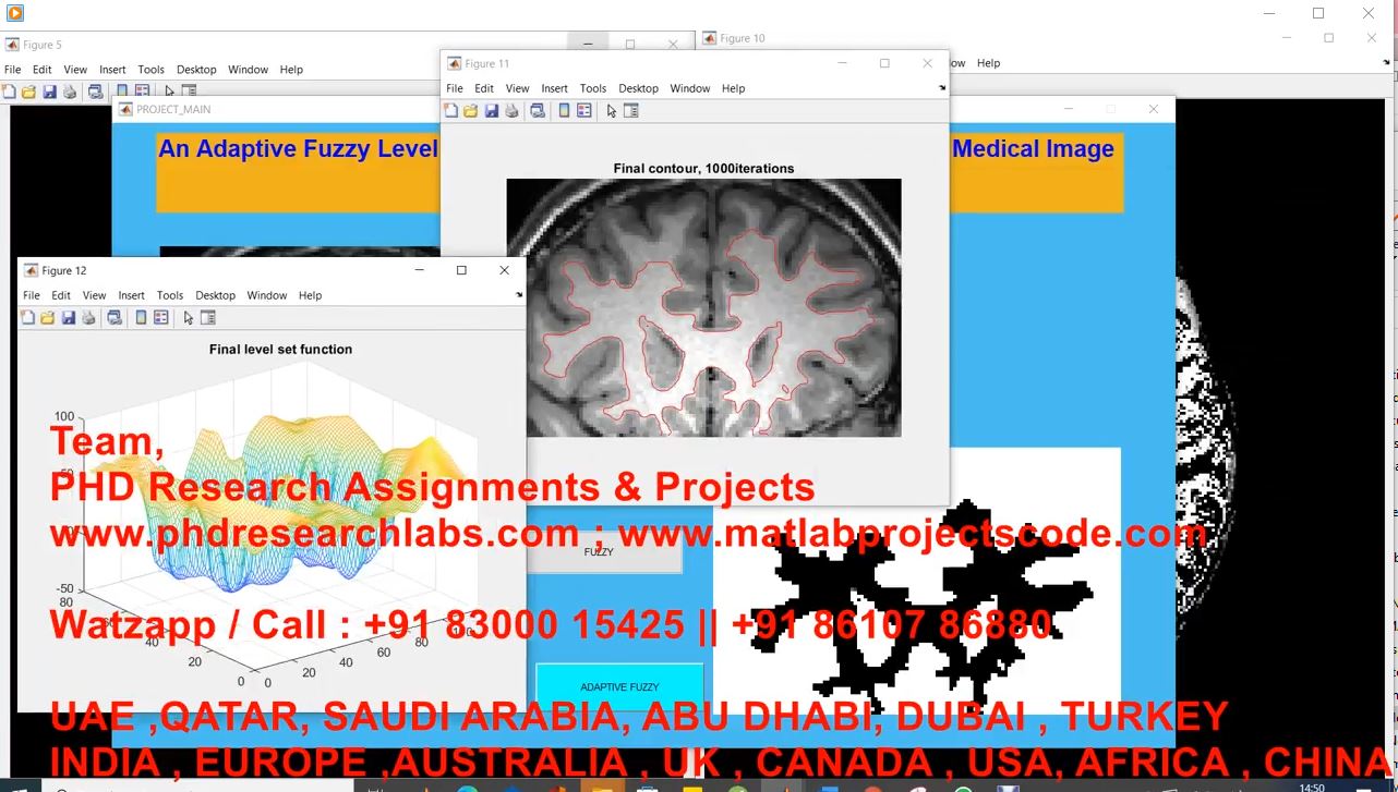An Adaptive Fuzzy Level Set Model With Local Spatial Information For Medical Image Segmentation project thumbnail image