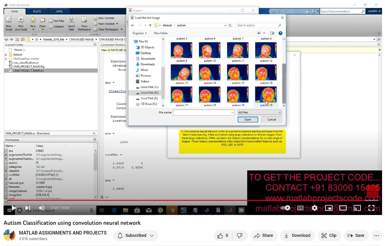Autism Classification Using Convolution Neural Network project simulation thumbnail for Signal Processing and AI Engineering