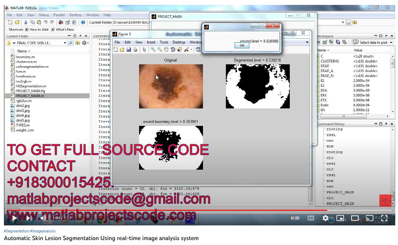 Automatic Skin Lesion Segmentation using Real-Time Image Analysis System project simulation thumbnail for Signal Processing and AI Engineering