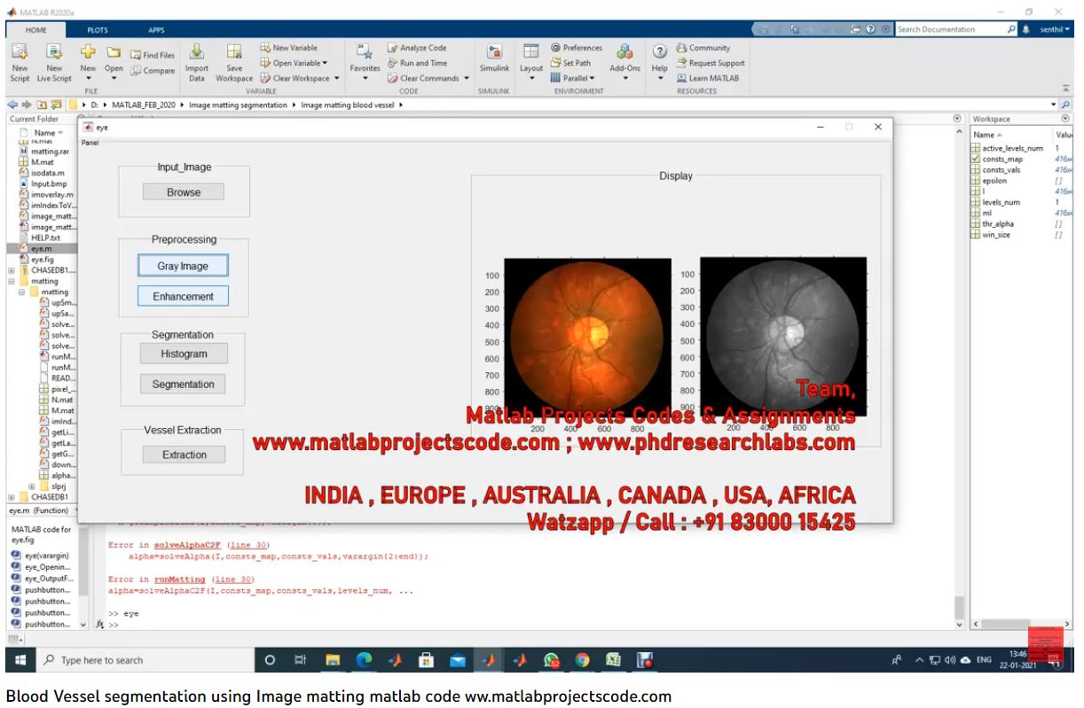 Blood Vessel Segmentation Using Image Matting Matlab Code project simulation thumbnail for Signal Processing and AI Engineering