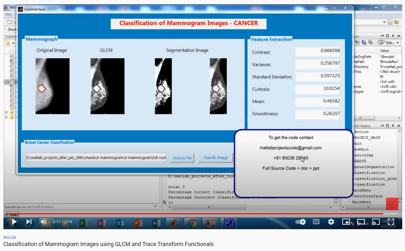Classification of Mammogram Images using GLCM and Trace Transform Functionals project simulation thumbnail for Signal Processing and AI Engineering