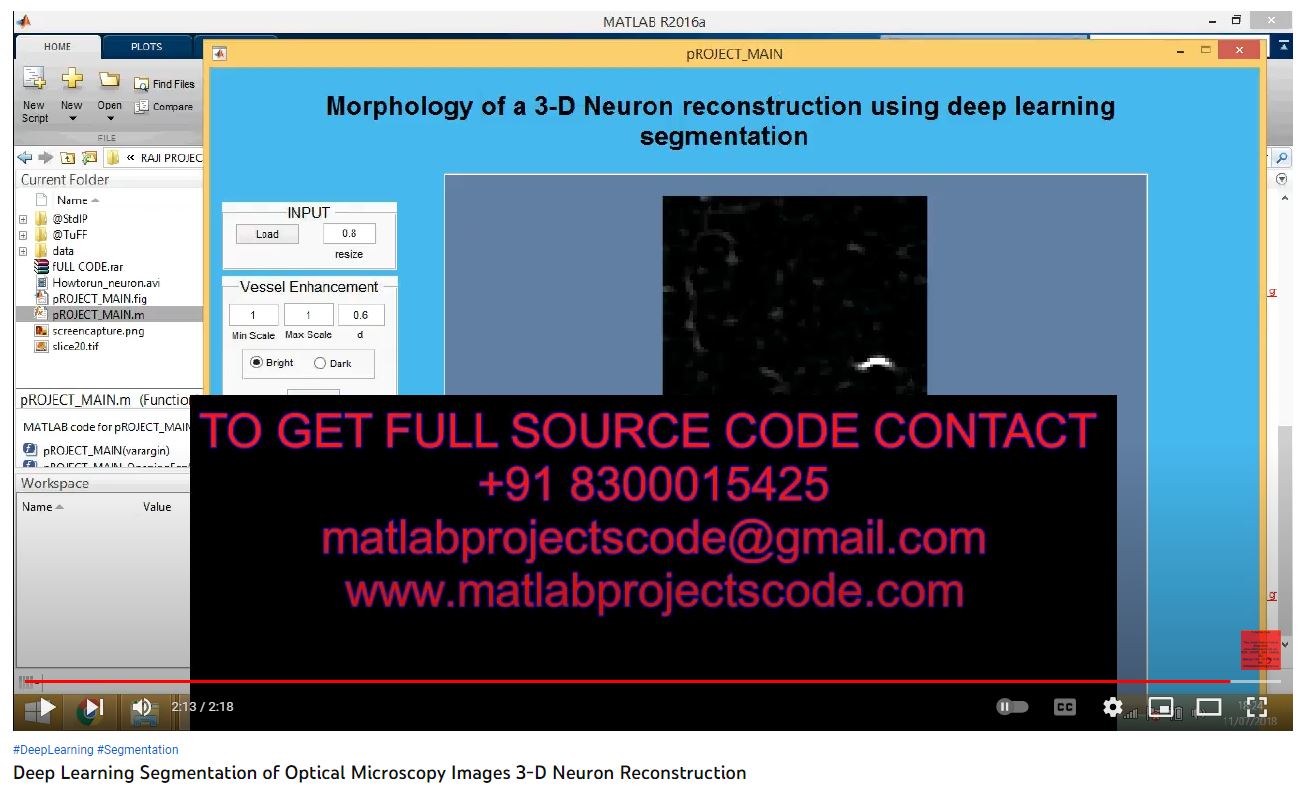 Deep Learning Segmentation of Optical Microscopy Images 3-D Neuron Reconstruction project simulation thumbnail for Signal Processing and AI Engineering