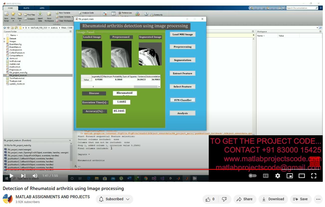 Detection Of Rheumatoid Arthritis Using Image Processing project simulation thumbnail for Signal Processing and AI Engineering
