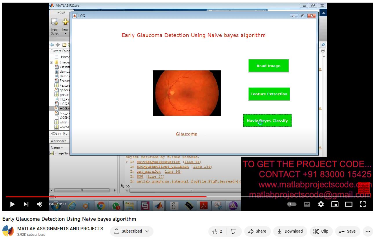 Early Glaucoma Detection Using Naive Bayes Algorithm project simulation thumbnail for Signal Processing and AI Engineering