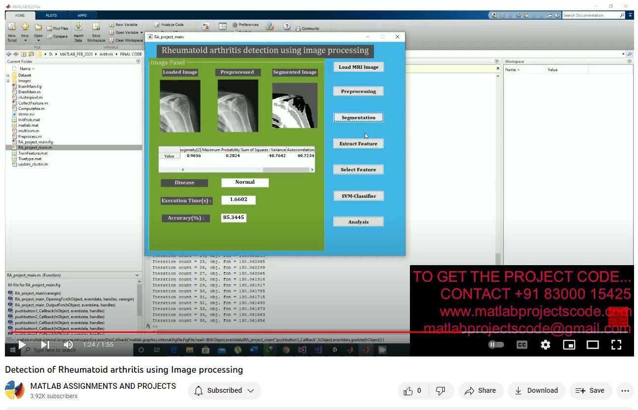 Rheumatoid Arthritis Detection Using Image Processing project simulation thumbnail for Signal Processing and AI Engineering