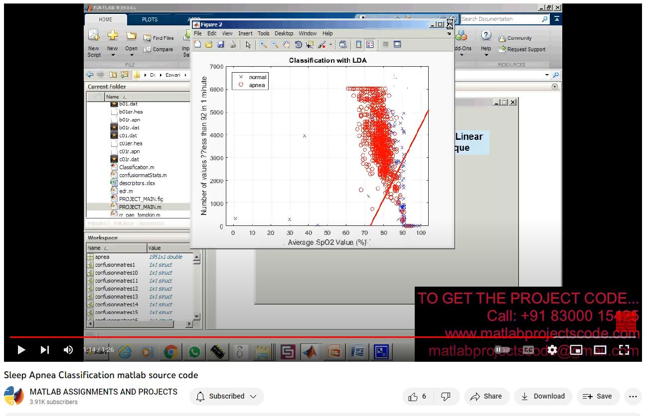 Sleep Apnea Classification Matlab Source Code project simulation thumbnail for Signal Processing and AI Engineering